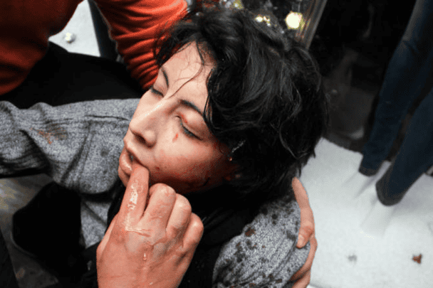 شيماء الصباغ والخرطوش watanserb.com