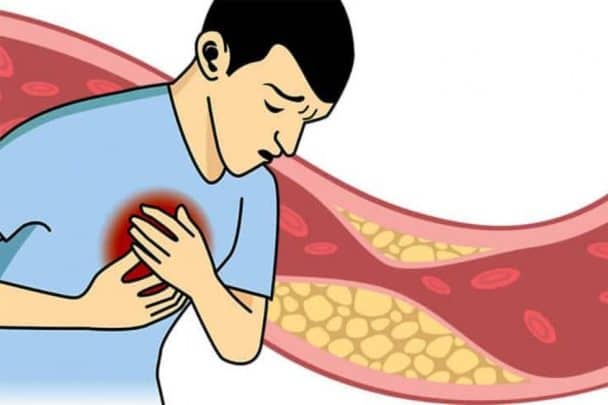 ارتفاع الكولسترول watanserb.com