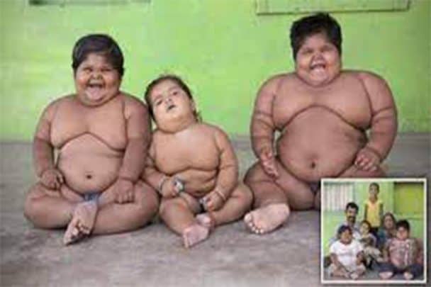 أضخم الأطفال في العالم من عائلة هندية أضخم الأطفال في العالم watanserb.com