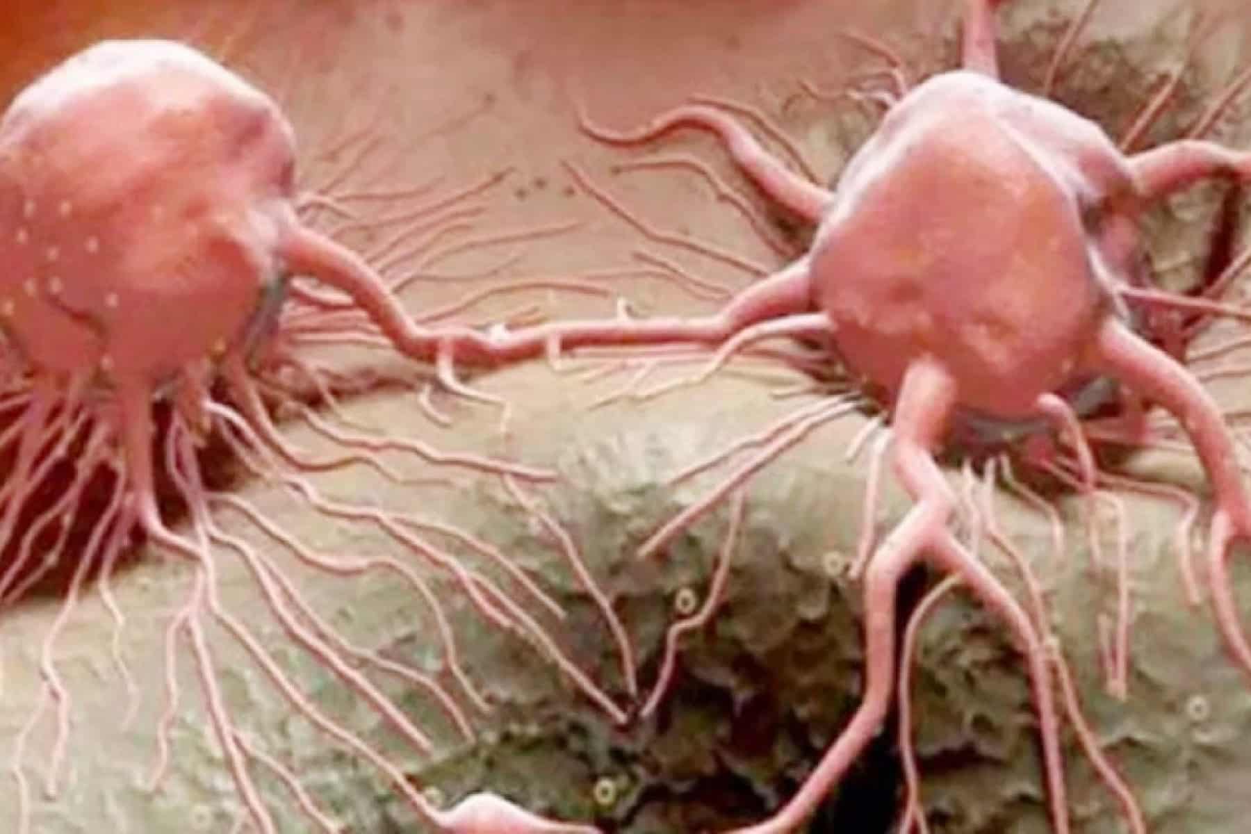 المانوز يثبط نمو عدة أنواع من السرطان