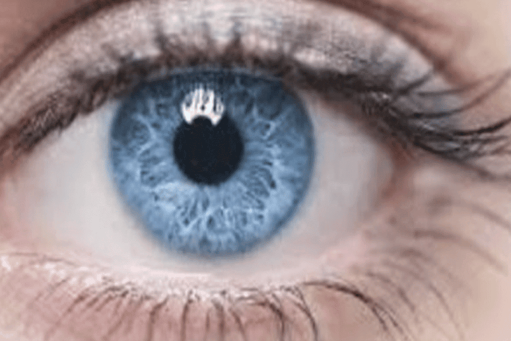 سرطان الجلد watanserb.com