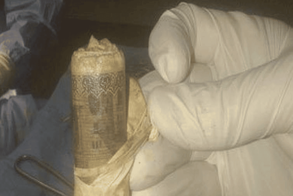 احشاء مريض مصري watanserb.com