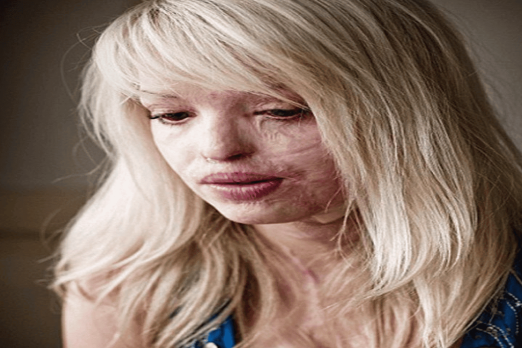 عارضة أزياء بعد 40 عملية تجميل watanserb.com