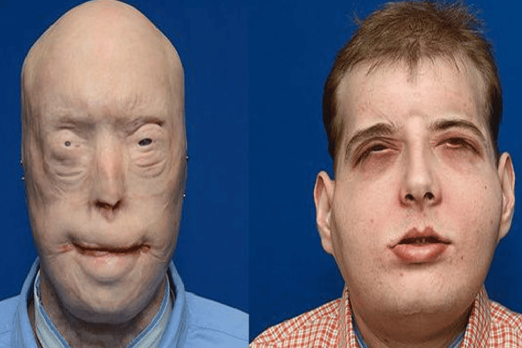 زراعة وجه كامل watanserb.com