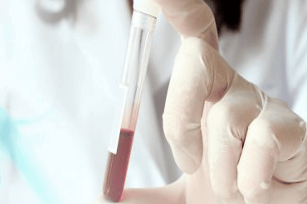 أهمية التيستوستيرون لمرضى السكري watanserb.com