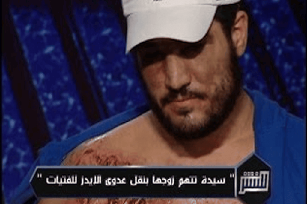 امرأة لبنانية تحرق زوجها بالأسيد بعد نقله الإيدز وإجباره على الدعارة امرأة تحرق زوجها بالأسيد watanserb.com