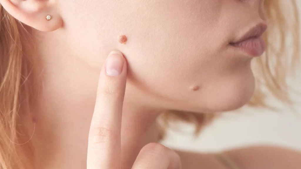 الشامة watanserb.com