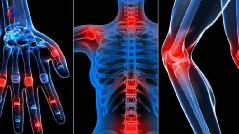 آلام المفاصل watanserb.com