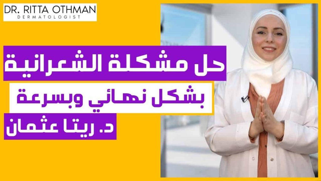 مشكلة الشعر الزائد