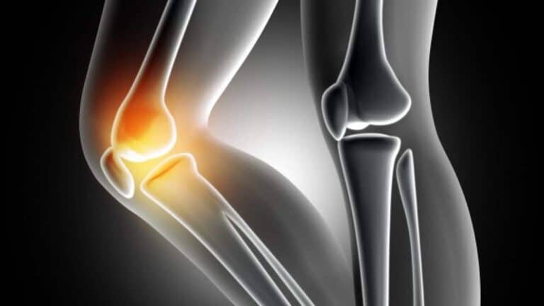 آلام المفاصل watanserb.com