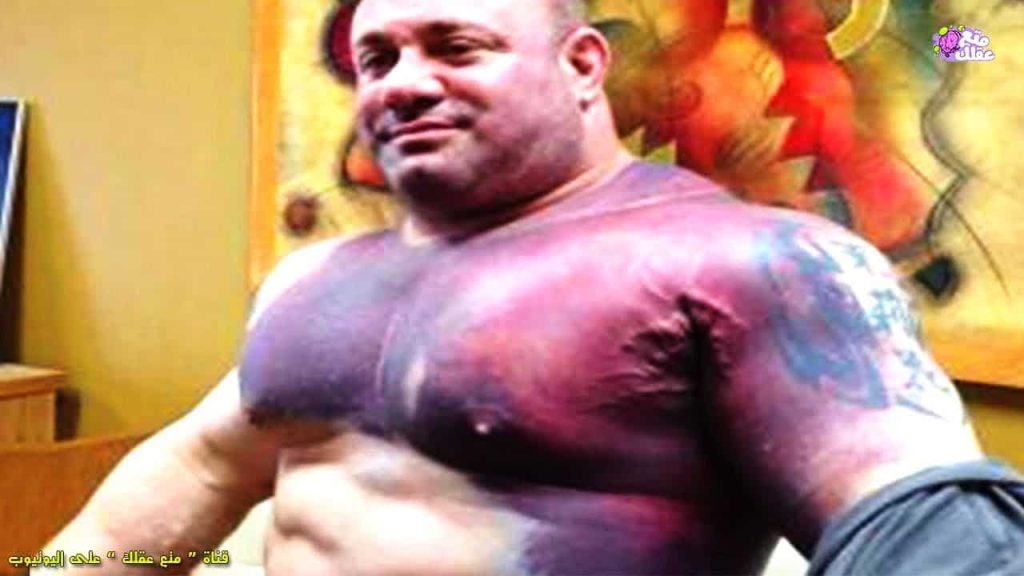 لاعبو كمال أجسام انفجرت عضلاتهم! | القصة الكاملة لاعبو كمال أجسام انفجرت عضلاتهم!