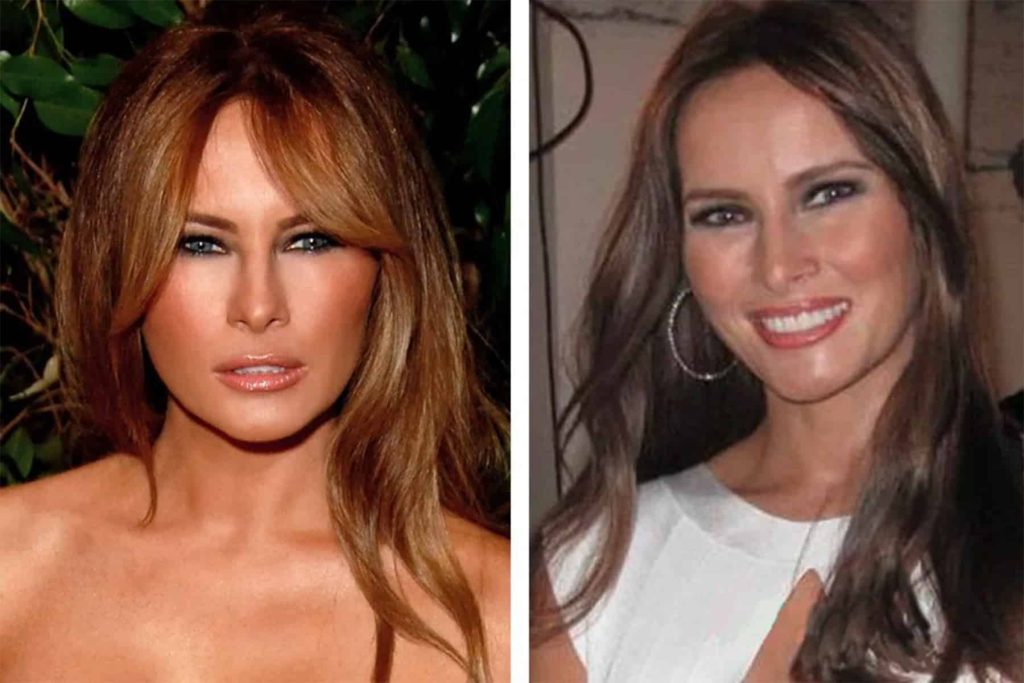 ميلانيا ترامب قبل عمليات التجميل watanserb.com