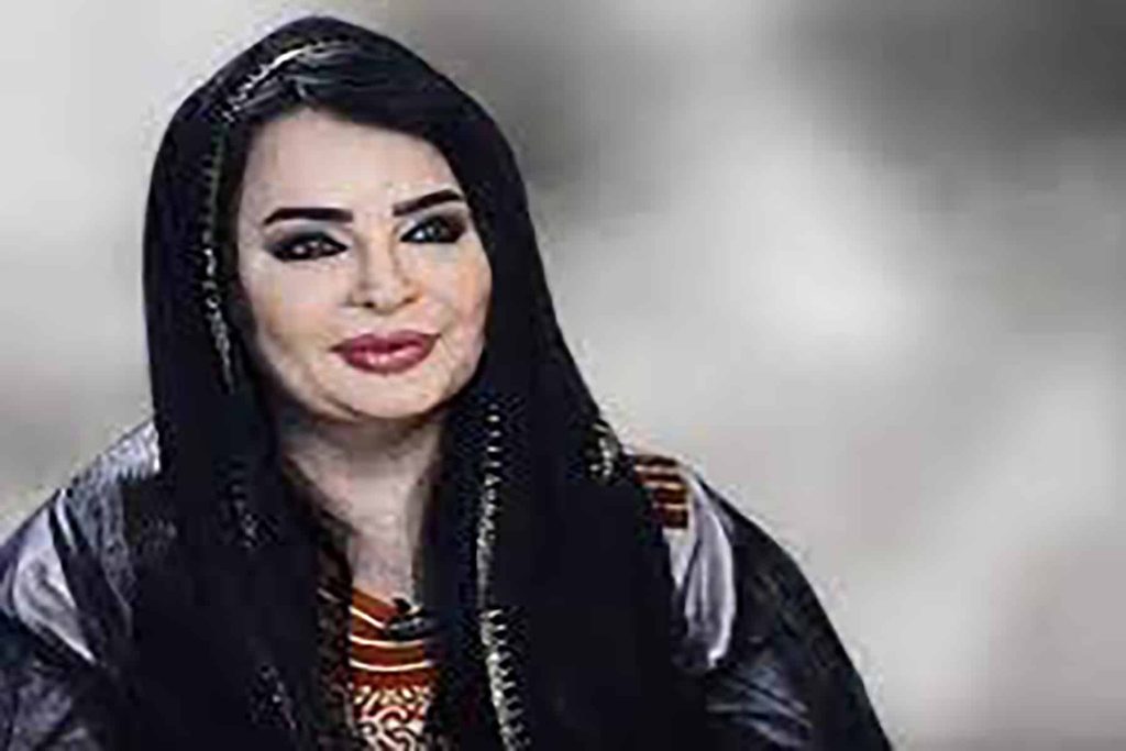 بدرية وإيحاءات الجنسية watanserb.com