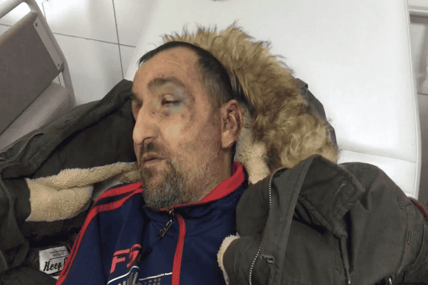 جنود الاحتلال يعتدون على فلسطيني كفيف.. كسروا أصابع يده وفكه السفلي وأصابوه إصابات بالغة | القصة الكاملة الاحتلال يعتدون على كفيف watanserb.com