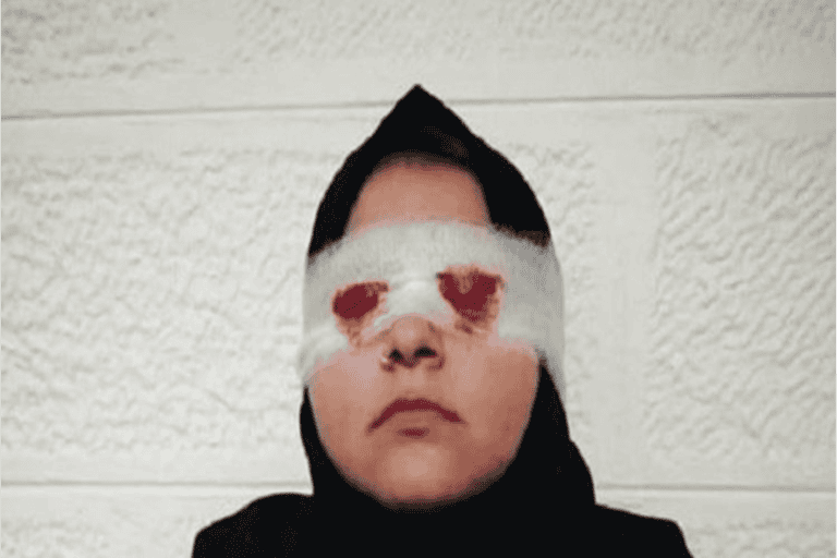 جرش تستيقظ على جريمة لم يشهد لها الأردن مثيلاً.. زوج يقتلع عينيّ زوجته أمام أطفالهما! | القصة الكاملة جريمة بشعة في الاردن watanserb.com