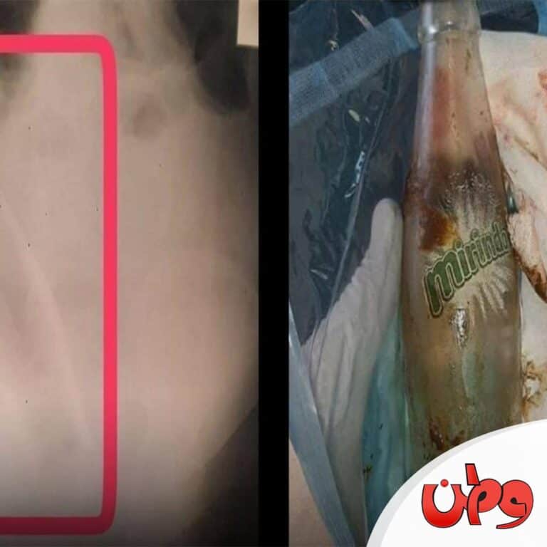 عملية جراحية غريبة watanserb.com