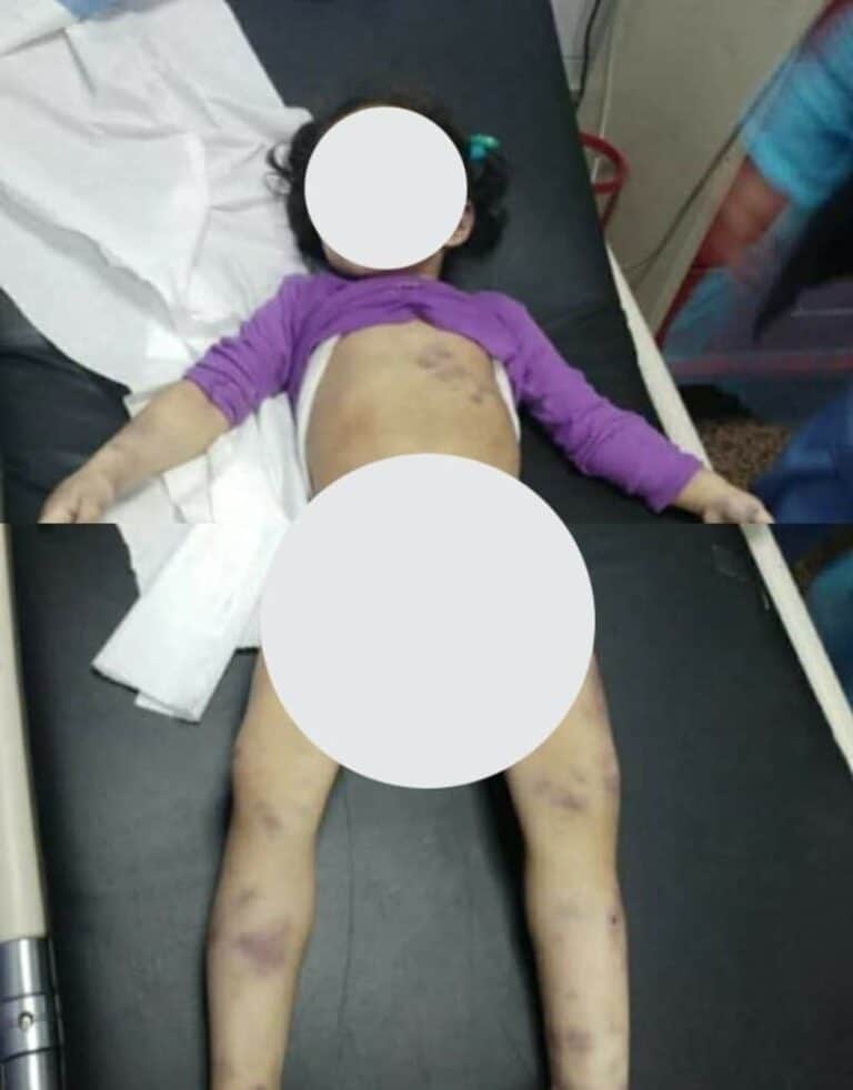 الطفلة الضحية watanserb.com