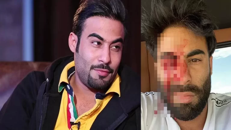 الفنان الكويتي عبدالله الجاسر المشهور بـ”عبودكا” watanserb.com