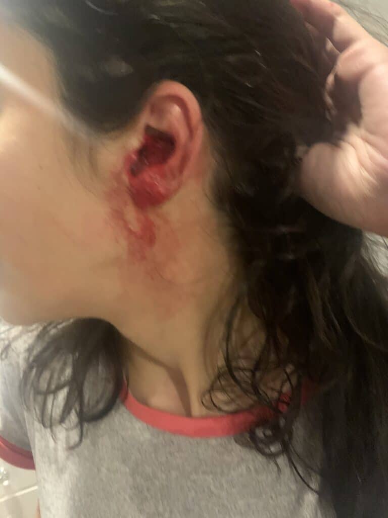 سعودي يقطع اذن اخته watanserb.com