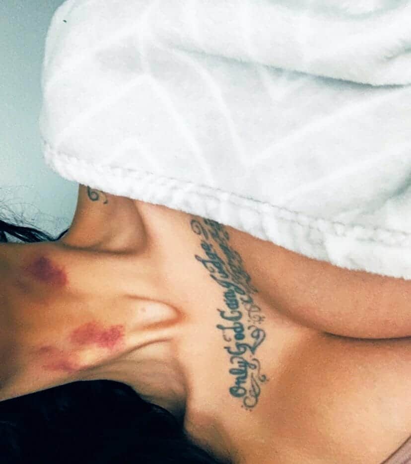 لا تتردد العنود العيسى بنشر صورها شبه عارية