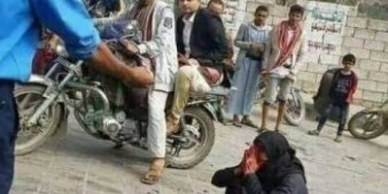 زوجة مواطن يمني تشهد جريمة قتل زوجها أمام الملأ على يد مرافق مدير أمن حجة زوجة الشيخ حميد طفيان watanserb.com