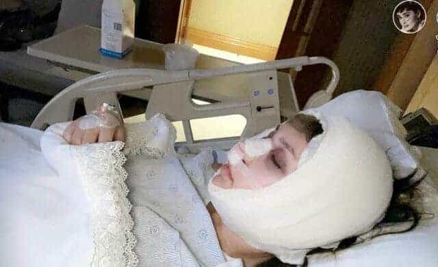 الدكتورة خلود تجري عملية جراحية في أنفها