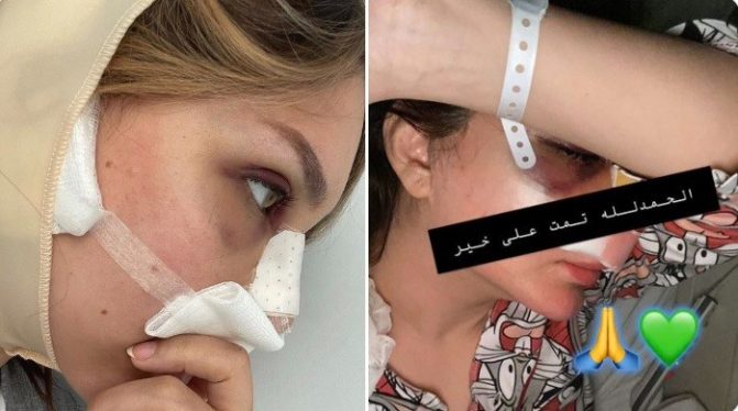 ما الذي حدث للممثلة الإيرانية المقيمة بالكويت شيماء علي بعد هذا المشهد الصادم؟! شيماء علي watanserb.com