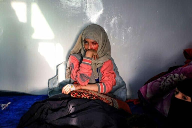 تحظى الشابة اليمنية العنود بتضامن واسع بعد تعرضها للاعتداء بالأسيد من طليقها الشابة اليمنية العنود تروي تفاصيل ما جرى معها watanserb.com