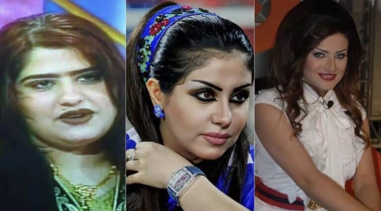 أمل العوضي - حليمة بولند - شمس الكويتية / صور قبل وبعد عمليات التجميل watanserb.com