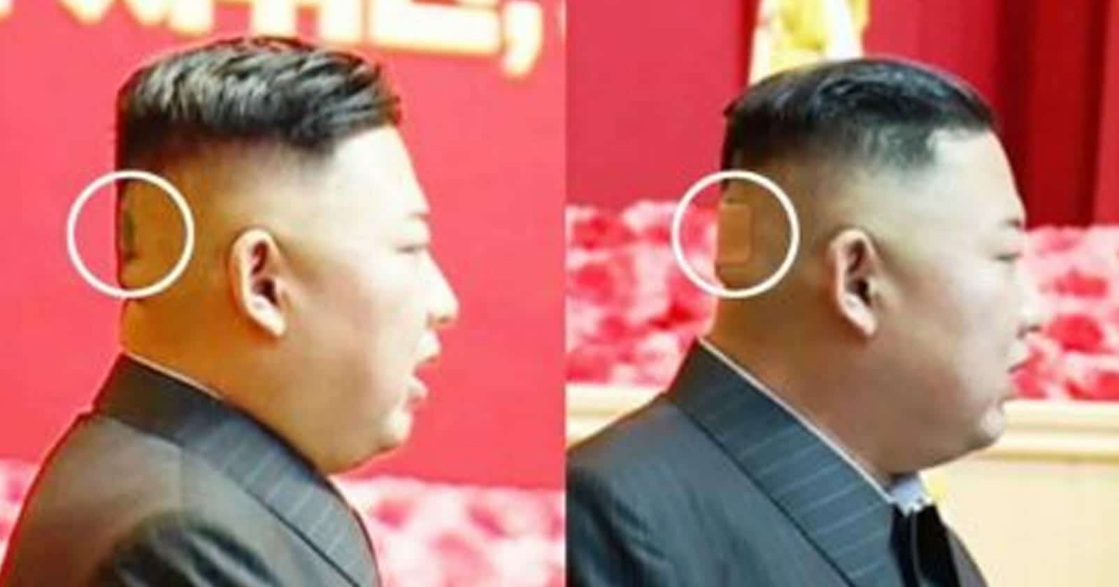 شاهد أحدث ظهور للزعيم كيم جونغ أون وما ظهر على رأسه من الخلف يثير جدلاَ! أحدث ظهور كيم جونغ أون watanserb.com