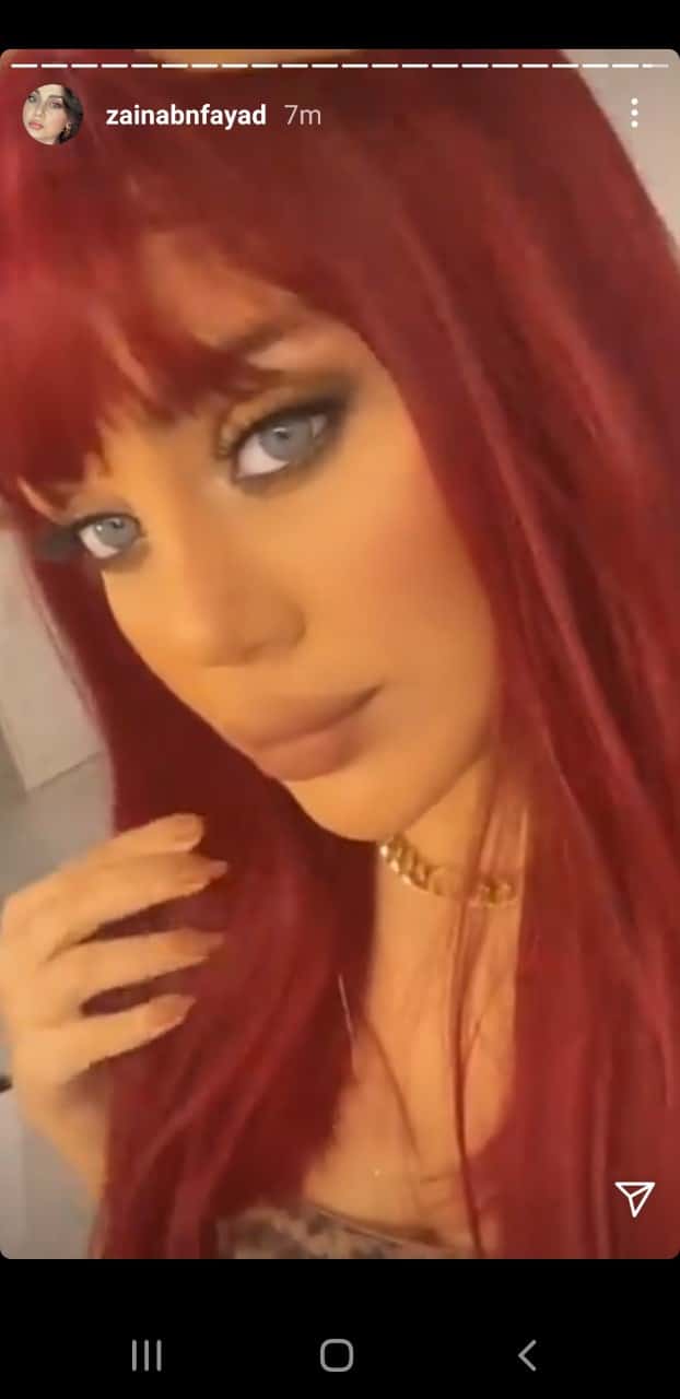 ابنة هيفاء وهبي زينب فياض بعد عملية في أنفها