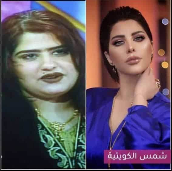 شمس الكويتية قبل وبعد