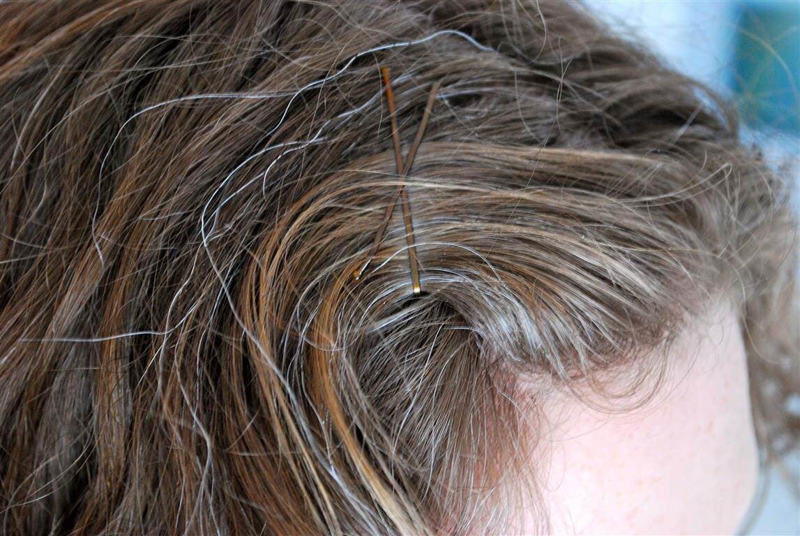 الشيب المبكر