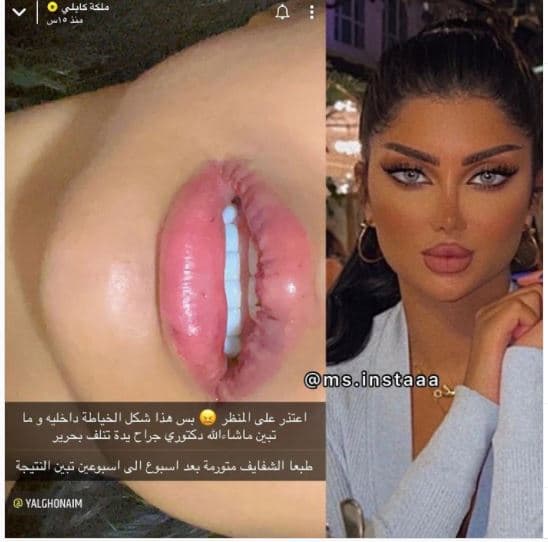 ملكة كابلي تفاجئ جمهورها