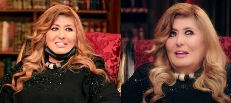 علامات البهاق تظهر على جسد سهير رمزي watanserb.com