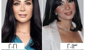 منى زكي قبل وبعد