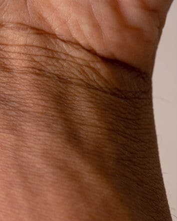 مع بداية فصل الخريف تواجه البشرة العديد من المشاكل منها الجفاف