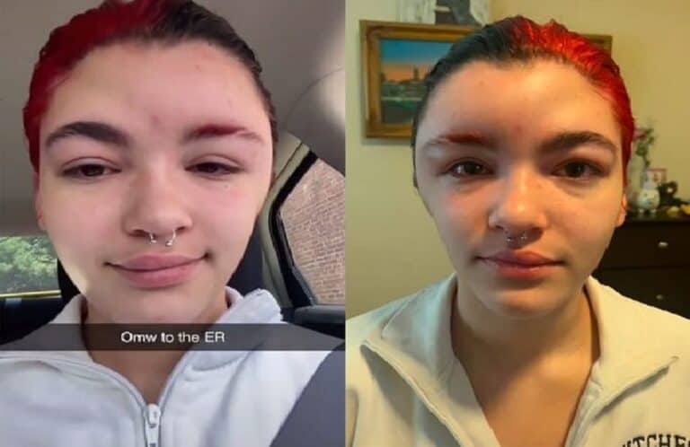 هذا ما فعلته "صبغة الشعر" بفتاة watanserb.com