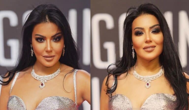 سمية الخشاب تفاجئ متابعيها بوجه منتفخ وملامح غريبة.. ماذا حدث لها؟ سمية الخشاب بوجه منتفخ watanserb.com