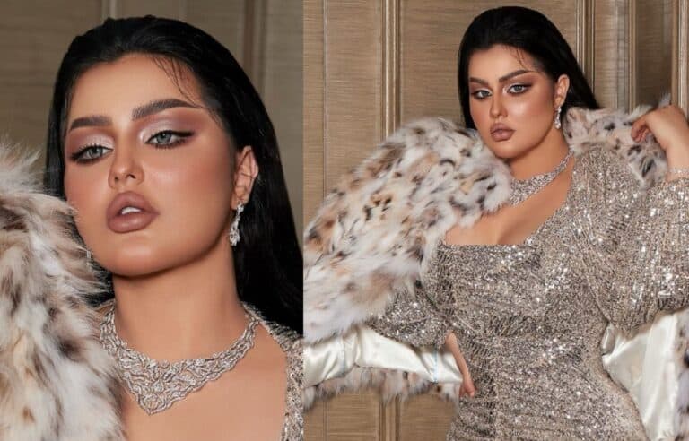 مودل شمس العراقية تبكي بعد تشوه جسدها watanserb.com