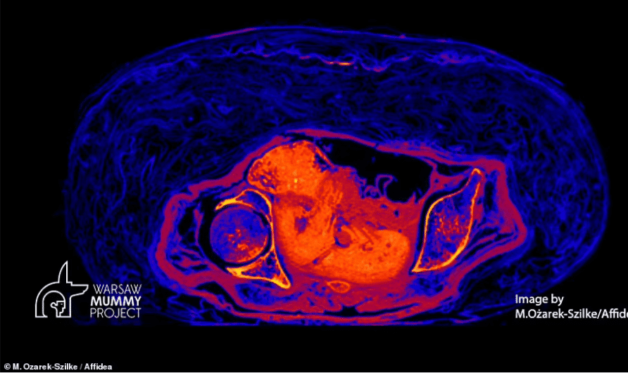 مومياء مصرية 