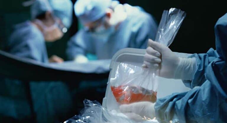 تجارة الأعضاء البشرية في تركيا watanserb.com