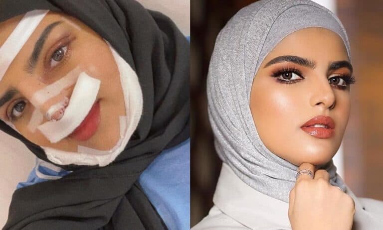 أنف سارة الودعاني حديث السعوديين بعدما كشفت شكلها الجديد الصادم watanserb.com