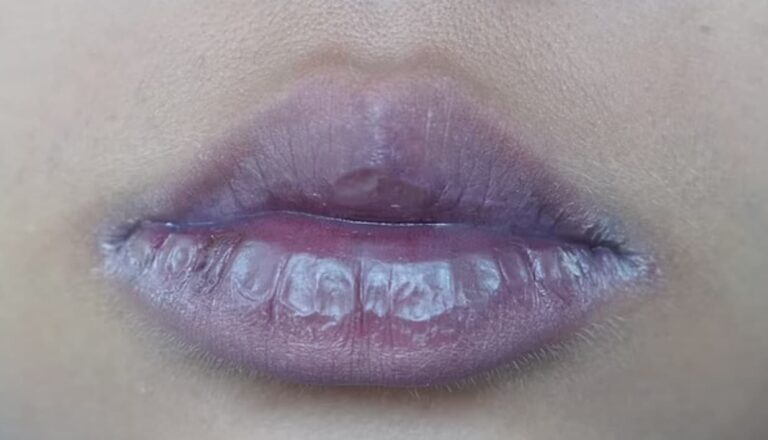 هل لون الشفاه الرمادية دليل على الإصابة بـ”أوميكرون”!؟ لون الشفاه الرمادي watanserb.com