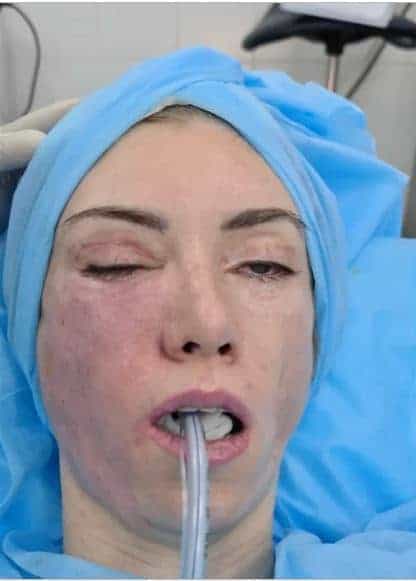 تدمير وجه ملكة جمال