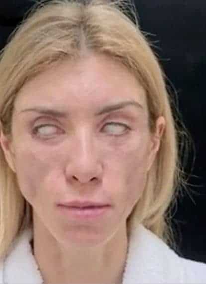 تدمير وجه ملكة جمال