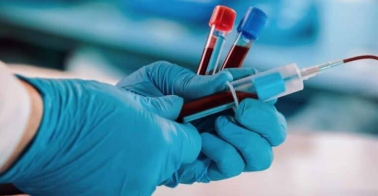 عصابة تخطف رجلاً ليكون عبداً للإتجار بالدم watanserb.com