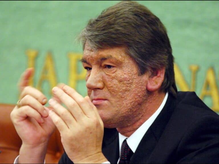 تسميم فيكتور يوشينكو watanserb.com