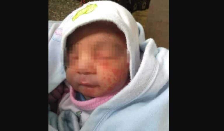 رضيع مصري أكله النمل وطفلة قاصر أسفل كوبري watanserb.com