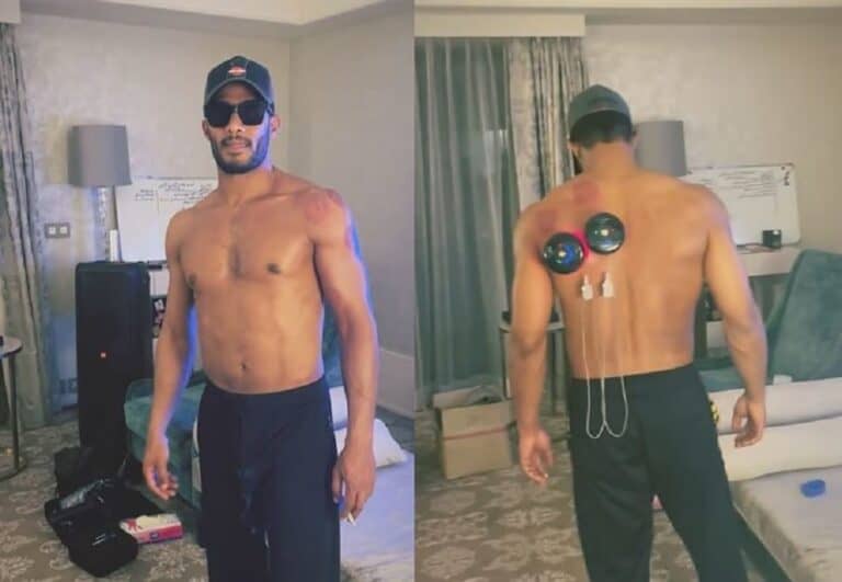 تناقض محمد رمضان يثير سخرية الناشطين.. هذا ما كان يفعله أثناء خضوعه للعلاج بالحجامة! (فيديو) watanserb.com